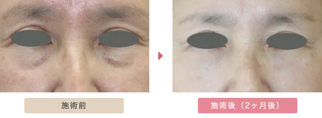 大塚美容形成外科の症例画像