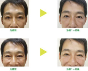 大西皮フ科形成外科医院の症例画像