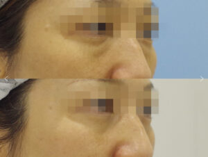 鳥丸御池ビューティークリニックの症例画像