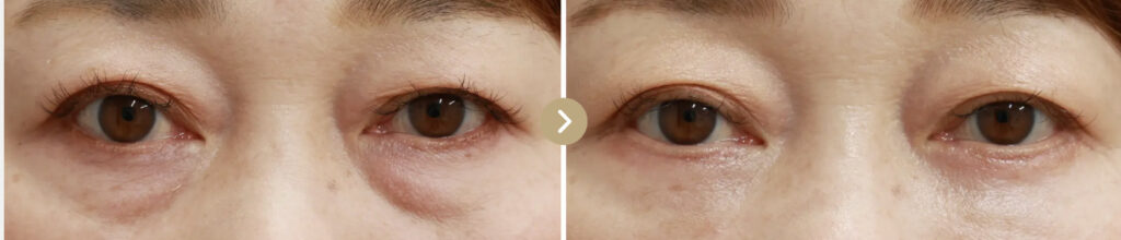 TAクリニックの症例画像