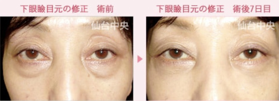 仙台中央クリニックの症例画像