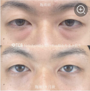 東京中央美容外科の症例画像