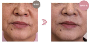 熊本かよこクリニックの症例画像