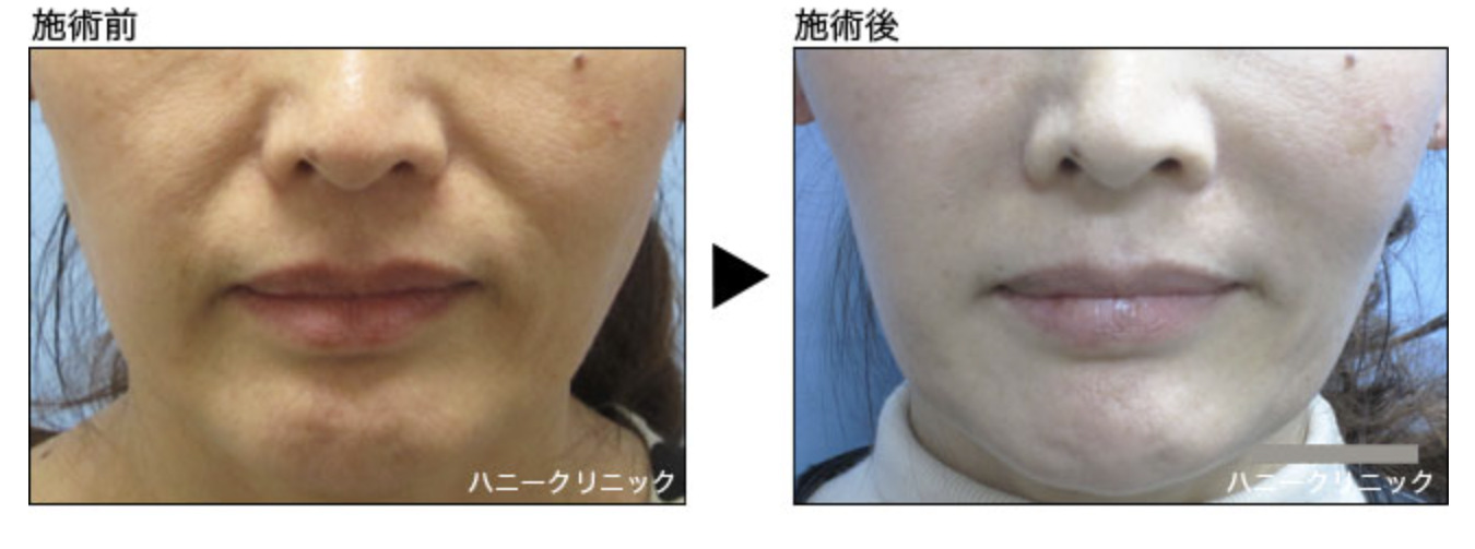 ハニークリニックの症例画像