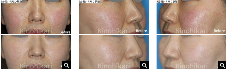 樹のひかり形成外科・皮ふ科の症例写真