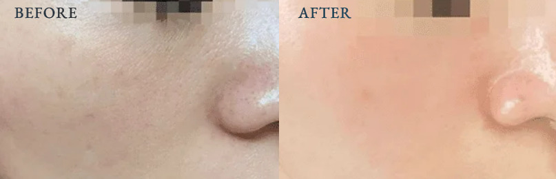 ジョウクリニックの症例画像