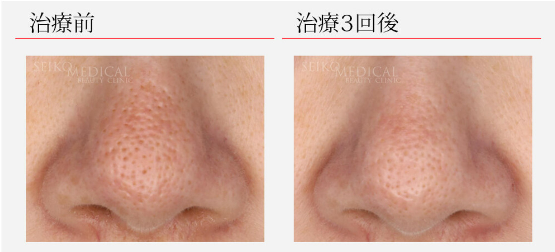 セイコメディカルビューティークリニックの症例画像