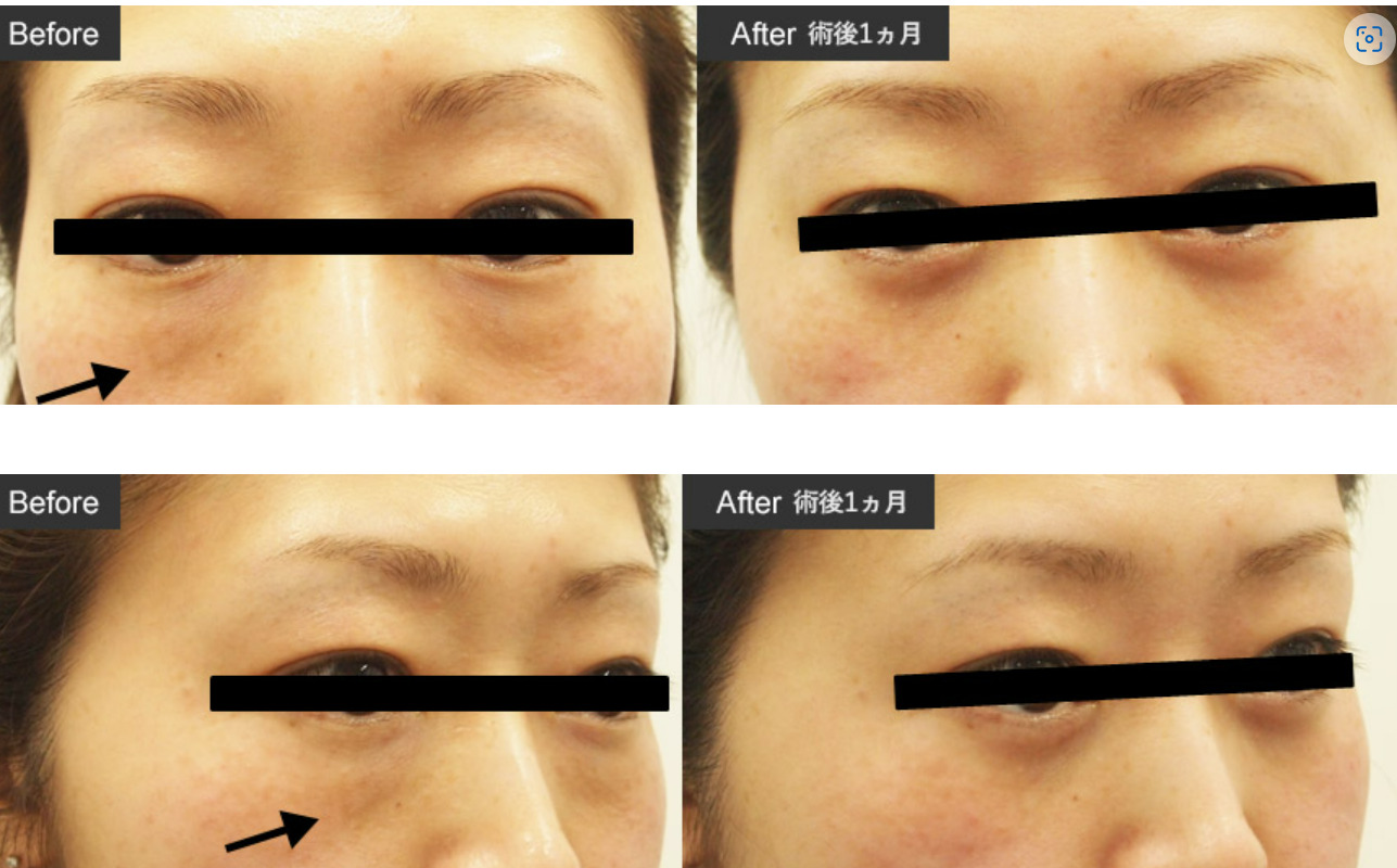 静岡美容外科橋本クリニックの症例写真