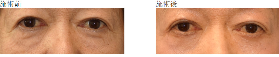 スキンクリニック藤枝の症例写真