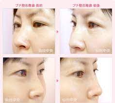 仙台中央クリニックの症例画像