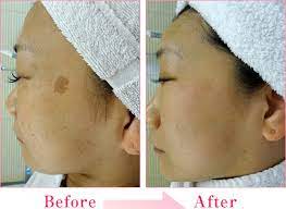 城本クリニックの症例画像