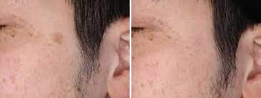 銀座よしえクリニックの症例画像