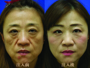 ヴェリィ美容形成クリニックの症例画像