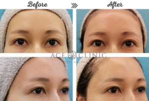 エースクリニックの症例画像