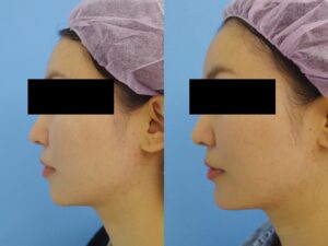 鳥丸御池ビューティークリニックの症例画像