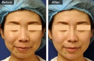 城本クリニック症例1