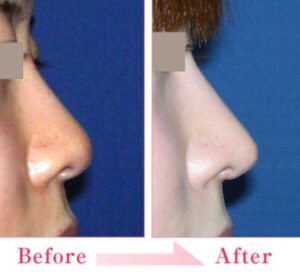 城本クリニック症例2