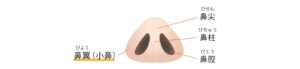 小鼻縮小術