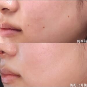 TAクリニック症例①