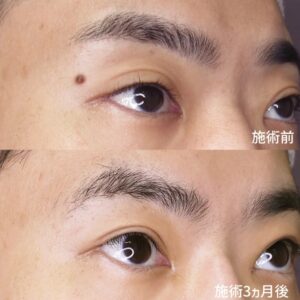 TAクリニック症例②