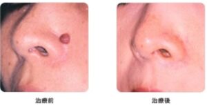 シロノクリニック症例①