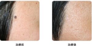 シロノクリニック症例②