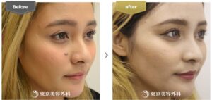 切開東京美容外科