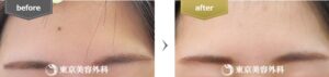東京美容外科症例①