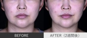 湘南美容症例①
