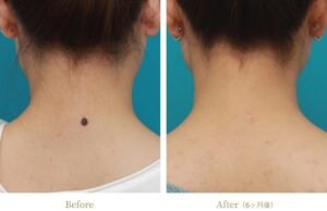 高須クリニック症例①