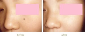 高須クリニック症例②